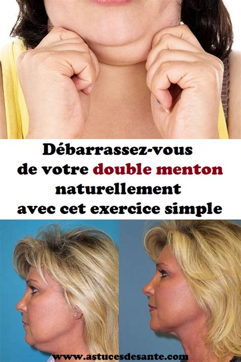 D Barrassez Vous De Votre Double Menton Naturellement Avec Cet Exercice