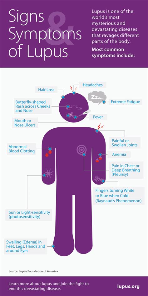 What Might My Symptoms Be? - NewLifeOutlook | Lupus