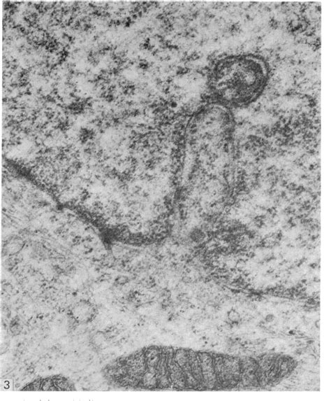 Figure 3 From The Three Dimensional Structure Of The Nucleolar Channel