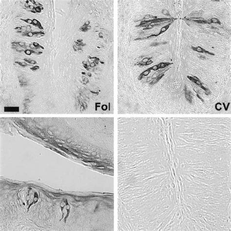 Examples of taste receptor cells from varying lingual structures ...