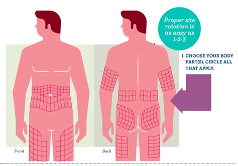 Ask A Cdces Why Should I Change My Insulin Injection Sites Beyond