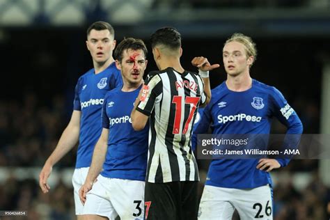 Leighton Baines Of Everton Suffers A Facial Injury During The Premier News Photo Getty Images