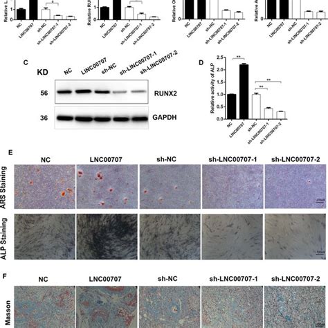 Linc00707 Stimulates Osteogenic Differentiation Of Hbmscs In Vitro And