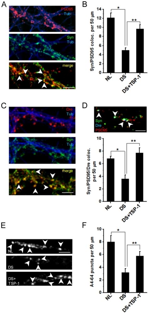 A Colocalization Of Post Synaptic Marker Psd Red And