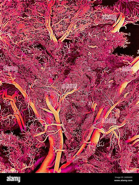 Blood Vessels Coloured Scanning Electron Micro Graph Sem Of A Resin