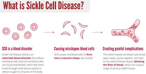 National Sickle Cell Anaemia Elimination Mission