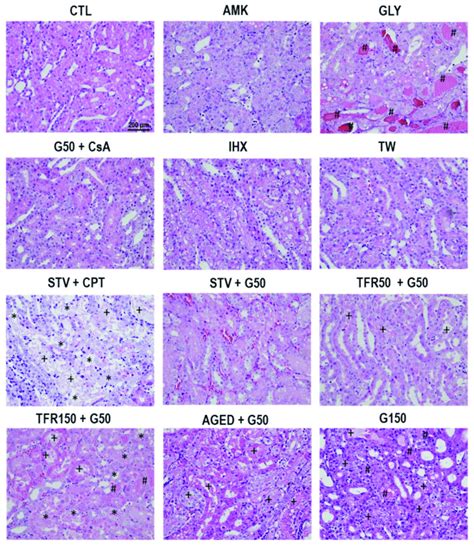 Outer medullary histology. Representative images of the renal outer ...