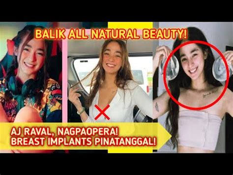 Ilang Celebrities At Si Aj Raval Nagpatanggal Ng Breast Implants