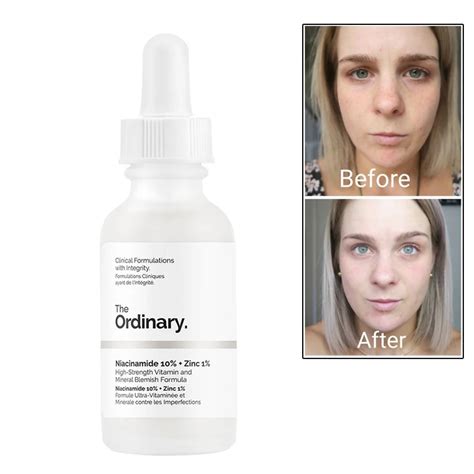 30ml Ordinary Niacinamide 10% + Zinc 1% 30ML Face Serum Oil Balance ...