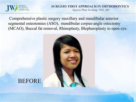 Surgery First Approach In Orthodontics Ppt