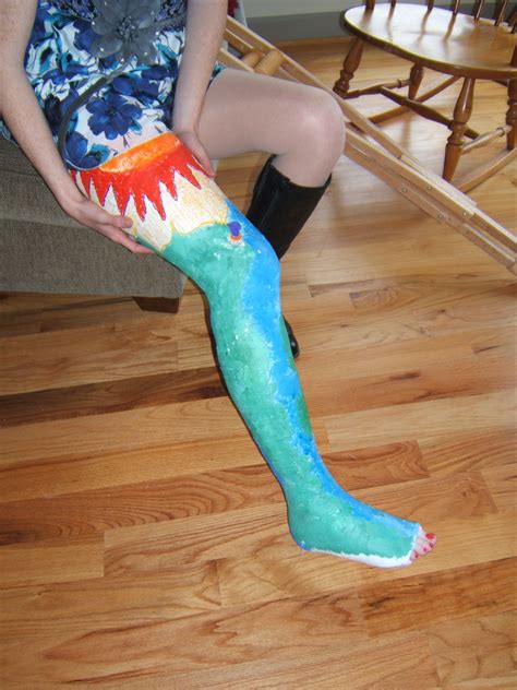 GIMPIX Showcasing The Artistry Of The Plaster Of Paris Leg Cast From