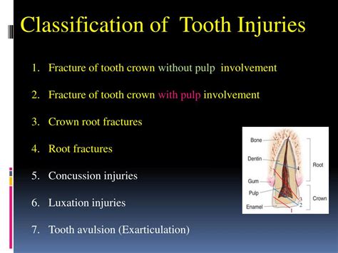 PPT Fractures Of The Teeth Jaws Joseph L McQuirter DDS Oral And