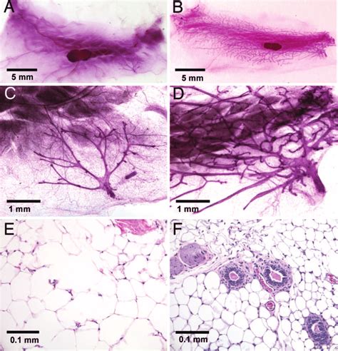 ER is required for mammary gland development. Whole mounts of mammary ...