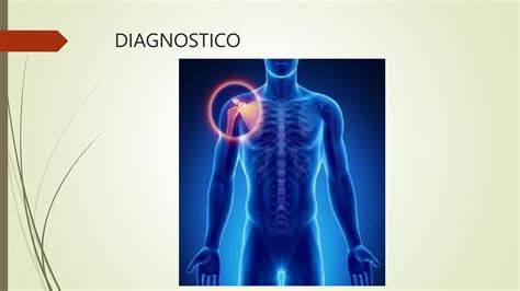 Capsulitis Adhesiva O S Ndrome De Hombro Congelado Pptx