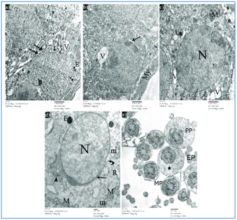 Electron Micrographs Of A Rat Of Subgroup Iiia Showing A A Sertoli