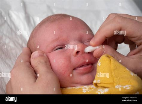 Cleaning Newborn Nose From Boogers With A Cotton Swab Stock Photo Alamy