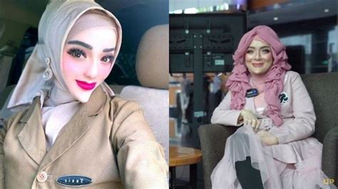 Potret Yuni Jasmine Wanita Berdagu Lancip Bantah Operasi Plastik Foto