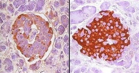 Histology Of Pancreatic Islet Cells