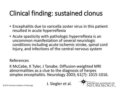 Abnormal Movements In An Unconscious Adult Teaching Neuroimages