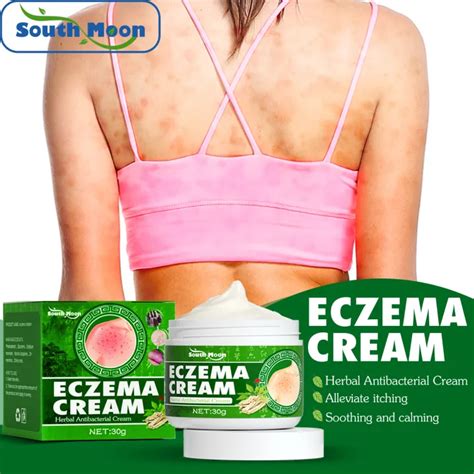 South Moon Eczema Cream Herbal Antibacterial Cream Skin Psoriasis Cream Dermatitis Eczematoid