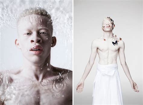 Unique Beauty Of Albino People | DeMilked