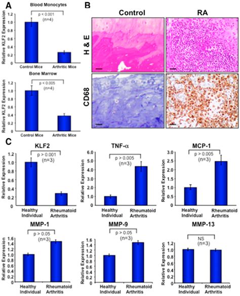 Cells Free Full Text Myeloid Krüppel Like Factor 2 Critically