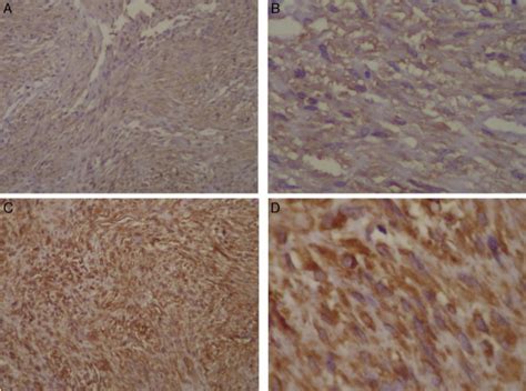 Microfotografías de la inmunohistoquímica positividad para actina