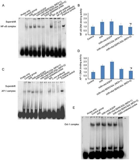 Effects Of The Overexpression Of Serca A On The Nf B And Ap