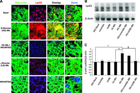 A Immunofluorescence Analysis Of B Actin Distribution And Lys