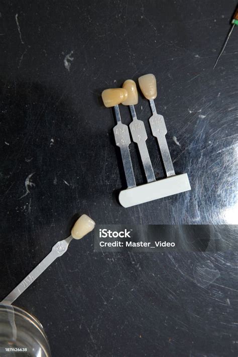 Fabrication Of Dental Crowns And Dentures Made Of Ceramic Scanning Of