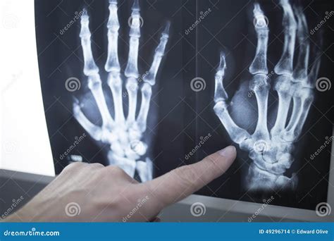 Medical Doctor Pointing At Radiograph X Ray Image Stock Photo Image