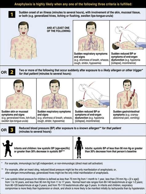 Anaphylaxis Diagnosis Pediatric Anaphylaxis