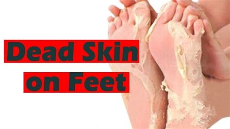 Best Way To Remove Dead Skin From Feet Top 5 Ways