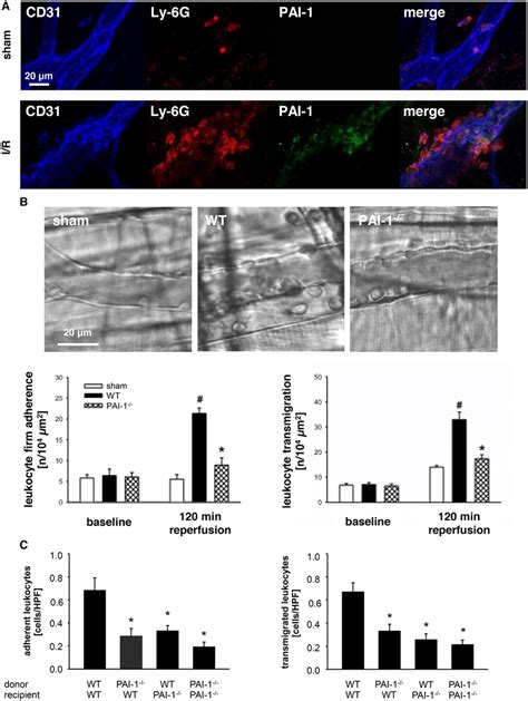 Role Of Plasminogen Activator Inhibitor 1 PAI 1 For Postischemic