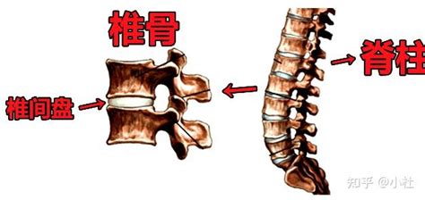 啥都不突出，就腰椎间盘突出？！ 知乎