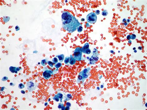 Urine Cytology Test DrBeckmann