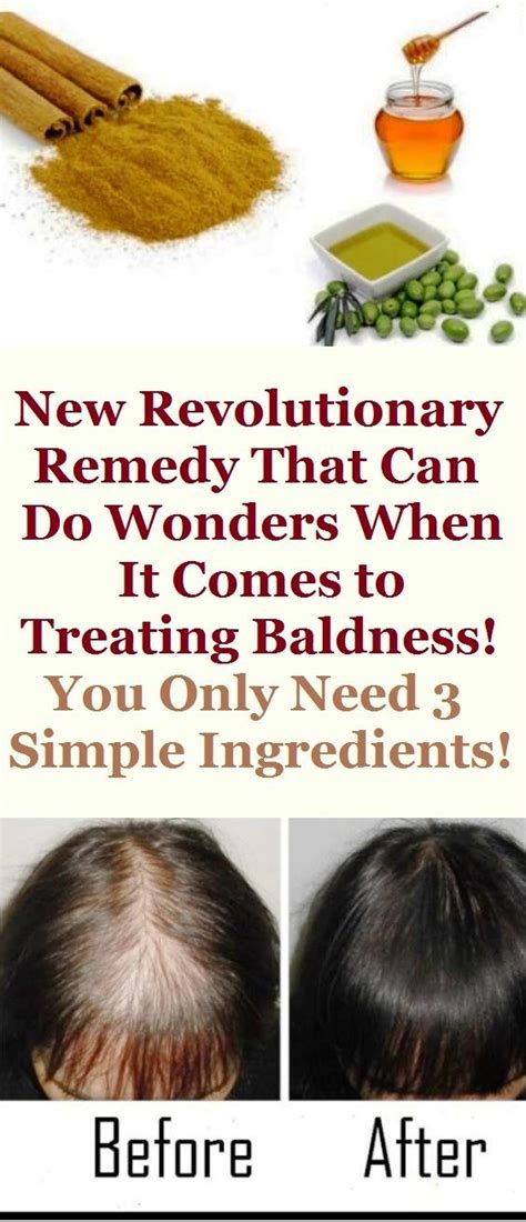 New Revolutionary Remedy That Can Do Wonders When It Comes To Treating Baldness You Only Need 3