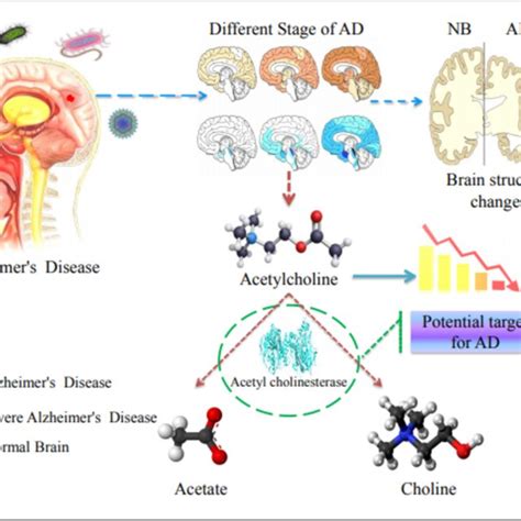 Overview Of Alzheimer S Disease Ad Acetylcholinesterase Ache Is