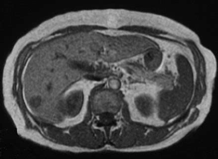 Cancer Imaging Program (CIP)