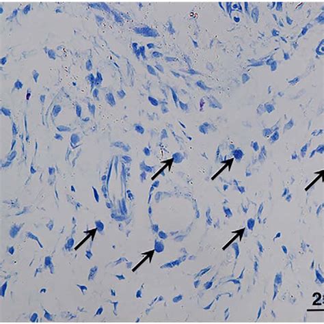 Distribution Of Mast Cells Arrows Toluidine Blue Stain X