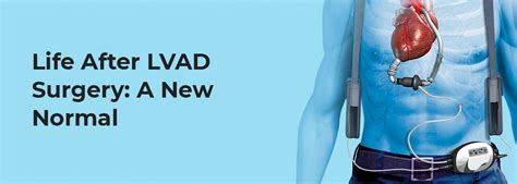 Life After LVAD Surgery: A New Normal