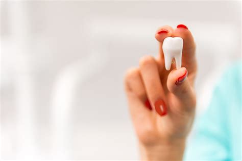 Non-impacted wisdom tooth removal - what you should know - South Gables ...