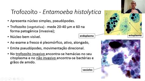 Morfologia Da Entamoeba Histolytica Librain