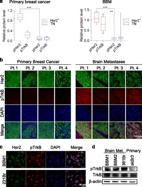 Human Epidermal Growth Factor Receptor 2 Her2 Positive Her2 Breast