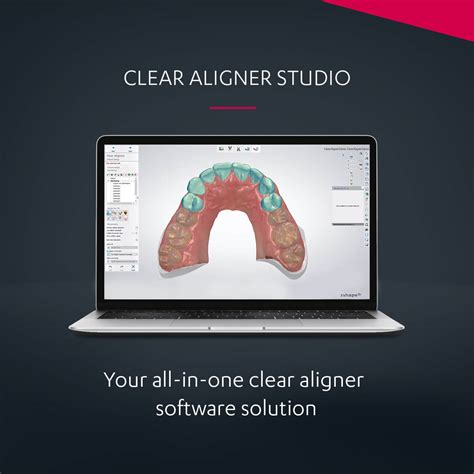 3shape Clear Aligner Studio 一体化牙齿正畸解决方案