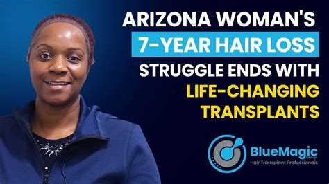 Arizona Woman S Year Hair Loss Struggle Ends With Life Changing Hair