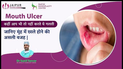 मुंह में छाले क्यों हो जाते हैं Mouth Ulcer Reasons And Treatments Dr Sunil Tanvar Youtube