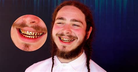 Post Malone Teeth Season Alyson Natalina