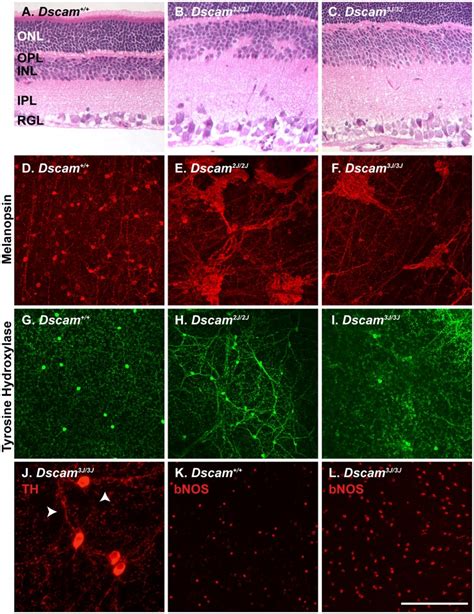 C Retinal Sections From Wild Type Dscam2j And Dscam3j Mice Were Download Scientific Diagram