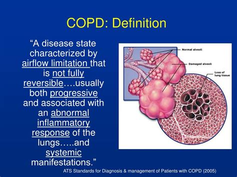 Ppt Copd Risks Treatment And Mortality Powerpoint Presentation Free Download Id4573697